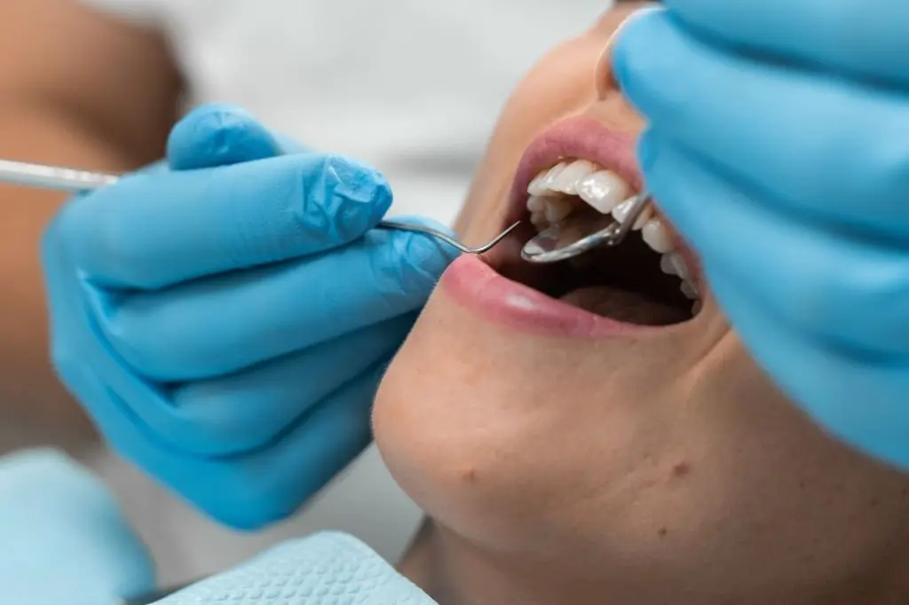 Implantes dentales Valencia